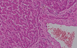 肝臟組織的觀察